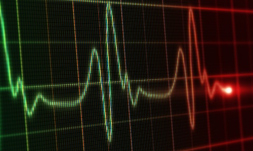 Image of heart rate on monitor.